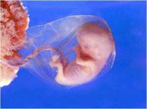 PreBorn Baby 8 Week Gestation
